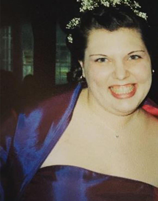 Ameliyat olmadan 60 kilo veren obez kadının inanılmaz değişimi! 